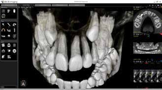 Rekonstrukcja CBCT 3D — przykładowy obraz z systemu Carestream CS 8100 3D