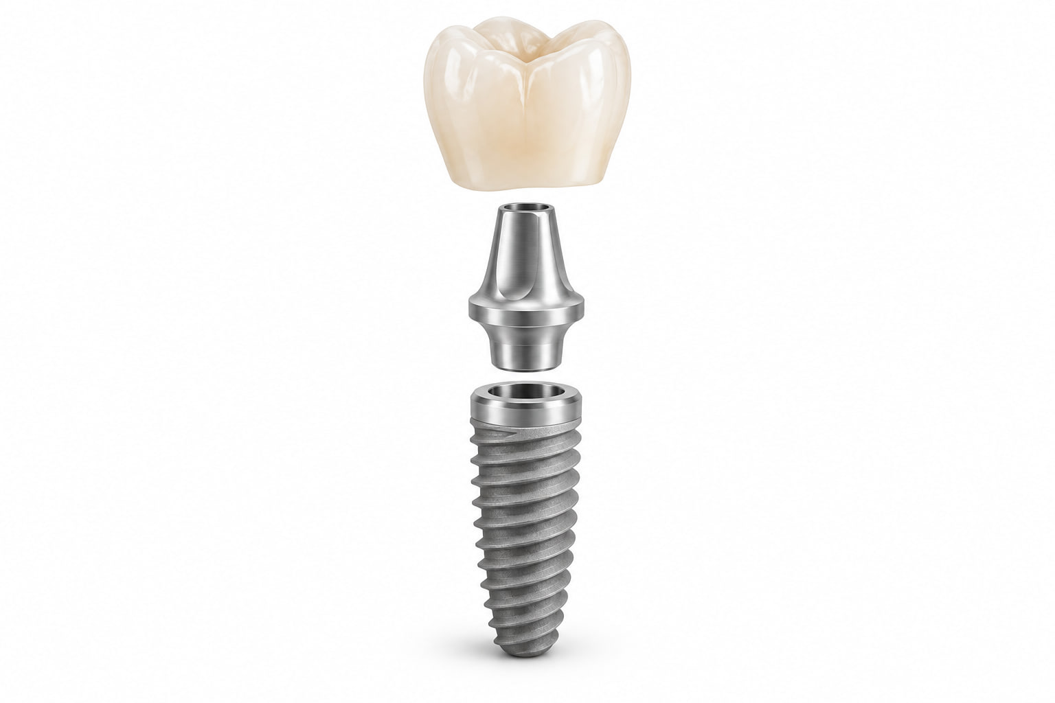 Rozdzielone elementy odbudowy: ceramiczna korona u góry, łącznik pośrodku i gwintowany implant poniżej